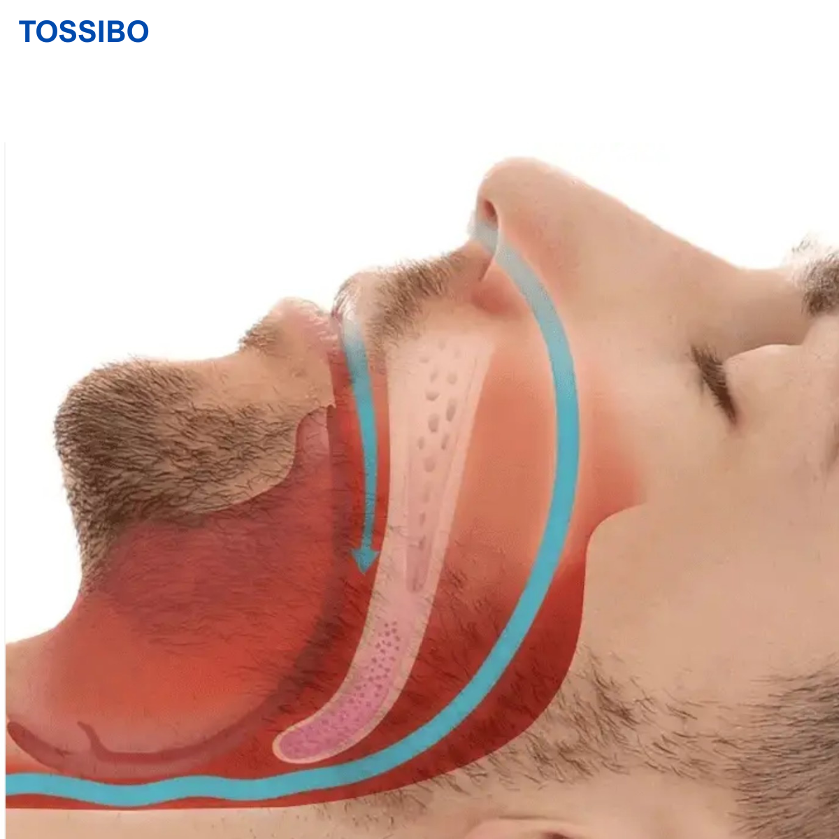 AirFlow™ – Uređaj protiv hrkanja i apneje u snu